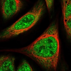 UBAP2L Antibody, Novus Biologicals 25 &mu;L; Unlabeled:Antibodies, Polyclonal